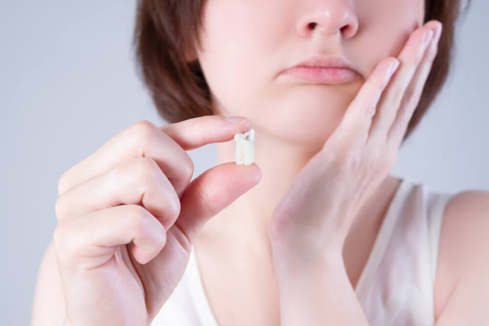 What To Expect From Wisdom Teeth Removal